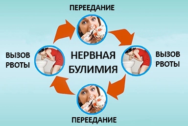 Лечение булимии в Лакинске